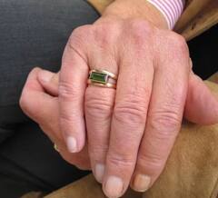 ਕੀ ਤੁਸੀਂ ਵੀ ਪਾਉਂਦੇ ਹੋ ਅੰਗੂਠੀ ? ਤਾਂ ਜਾਣੋ ਇਸ ਦਾ ਤੁਹਾਡੀ ਸਿਹਤ 'ਤੇ ਕੀ ਅਸਰ ਪੈਂਦਾ ਹੈ?