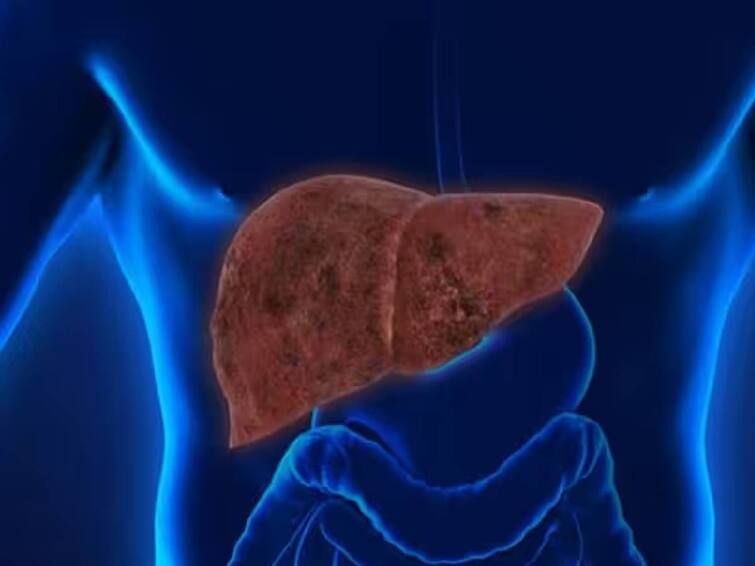 Studies show that the number of deaths due to chronic liver disease has increased in India. Liver Disease: இந்தியாவில் கல்லீரல் நோயால் உயரும் உயிரிழப்புகள்.. அறிகுறிகள் என்ன? மருத்துவர்கள் சொல்லும் அட்வைஸ் இதோ..
