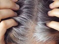 क्यों उम्र बढ़ने पर सफेद होने लगते हैं बाल, वैज्ञानिकों ने लगाया पता, मिल सकता है इलाज?