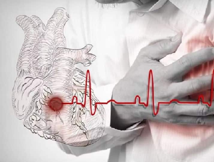 Silent Heart Attack: Symptoms And Prevention Methods You Need to Know Health: மாரடைப்பு ஏற்படுவதற்கான காரணங்கள் என்னென்ன..? எவ்வாறு தடுக்கலாம்..?