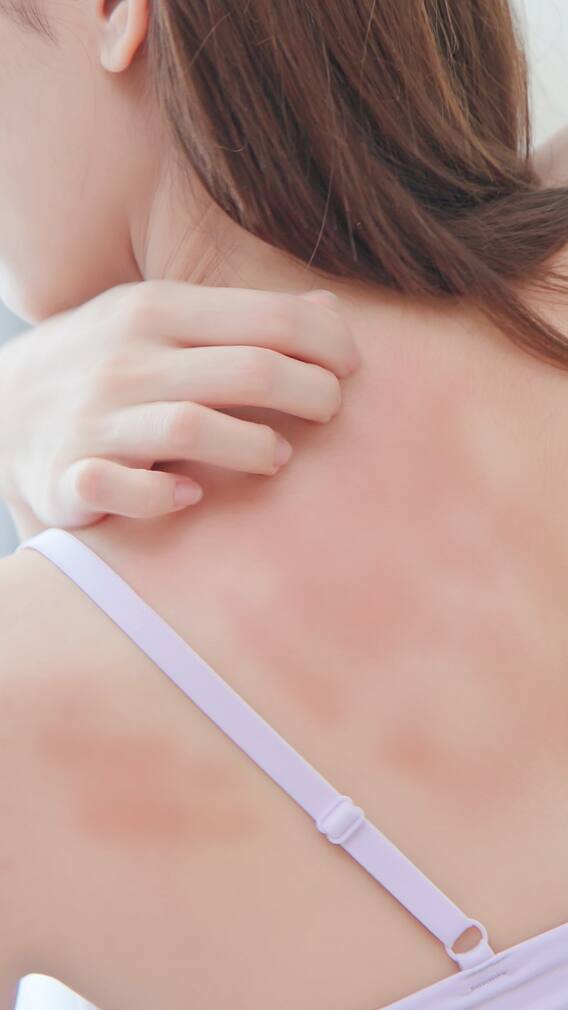 সারা গা চুলকোচ্ছে, শুধুই ত্বকের শুষ্কতা নয়, কারণ হতে পারে আরও গভীর