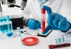 लंबी जिंदगी जीने के लिए हर किसी को जरूर कराना चाहिए ये 8 हेल्थ स्क्रीनिंग टेस्ट