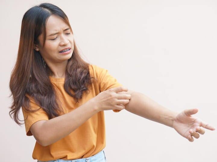 अगर ये 5 ट्रिक फॉलो कर लेंगे तो गर्मियों में नहीं होगी घमौरियों की समस्या