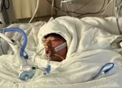 टिक टॉक चैलेंज पूरा करने के चक्कर में पूरी तरह जल गया यह बच्चा, मां ने बिलखते हुए की खास प्रार्थना