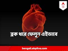 হার্টের অসুখের প্রধান কারণই ব্লকেজ, কোন কোন পরীক্ষায় আগাম ধরা পড়বে ?