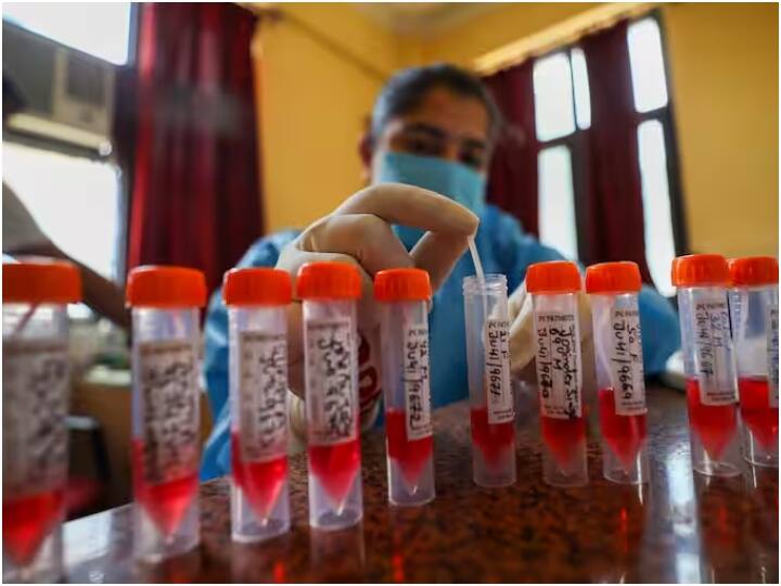 MP Coronavirus Update sharp decline seen in covid 19 cases positivity rate comes below 2 percent ann MP Corona Update: मध्य प्रदेश से छंटता दिख रहा है कोरोना का संकट, नियंत्रण में स्थिति, केवल 163 एक्टिव केस