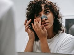 ঘরোয়া পদ্ধতিতে কীভাবে দূর করবেন ব্ল্যাকহেডসের সমস্যা?