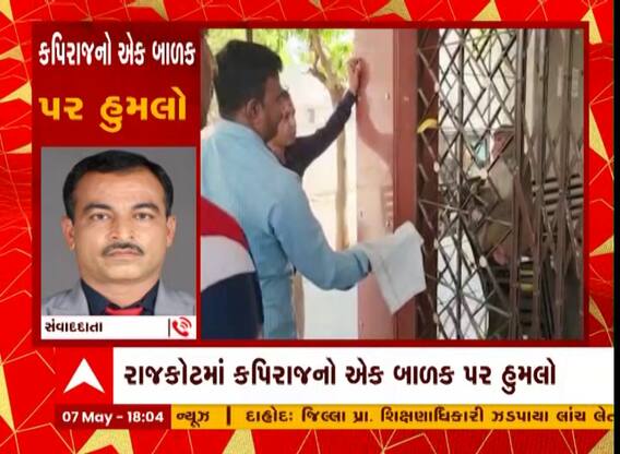 Rajkot : કાલાવડ રોડ પર વાંદરાનો આતંક, હુમલો કરતાં બાળકને ગંભીર ઇજા પહોંચી