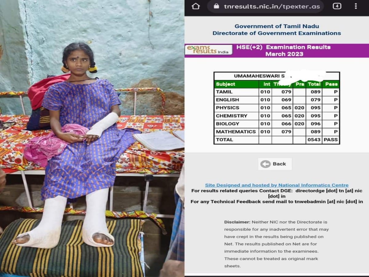 TN 12th Result 2023: உடைந்த கால்கள்.. முறிந்த கை.. படுத்த படுக்கை..! 543 மதிப்பெண்கள் எடுத்த அரசுப்பள்ளி மாணவி..!