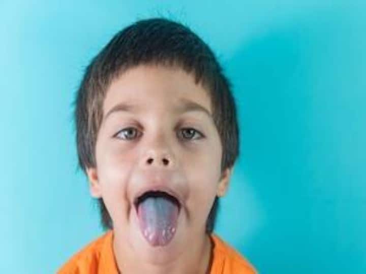 health tips  warning signs on tongue know its color and symptoms जीभ का रंग बताएगा आपकी सेहत का हाल, जानें कब जाना चाहिए डॉक्टर के पास