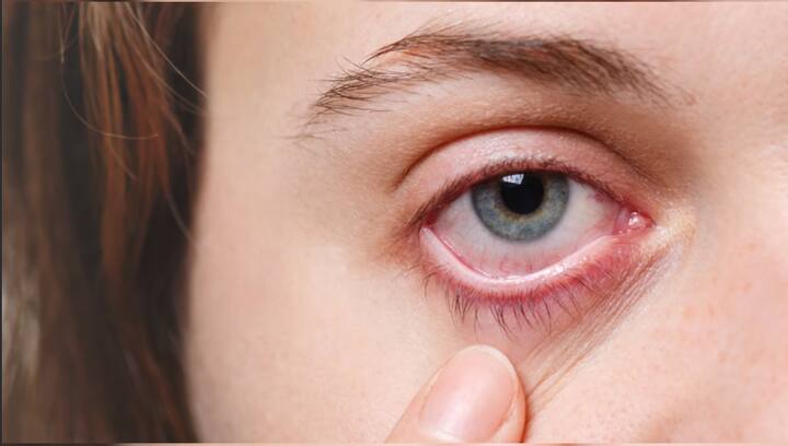 ਏਅਰ ਕੰਡੀਸ਼ਨਰ ਦੀ ਵਰਤੋਂ ਨਾਲ ਸਾਡੀਆਂ ਅੱਖਾਂ ਖੁਸ਼ਕ ਹੋ ਸਕਦੀ ਹੈ।