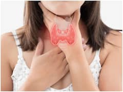 Thyroid: హైపర్ థైరాయిడిజం ఉందా? ఎముకలు విరుగుతాయి జాగ్రత్త