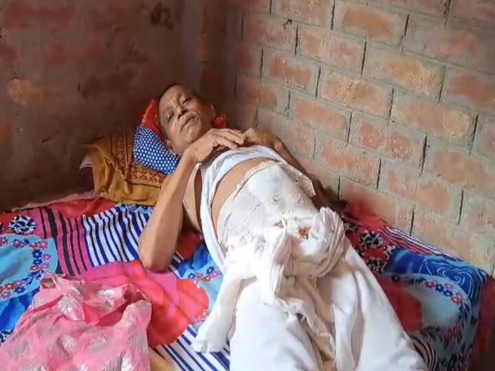 Doctor removes hydrocele of patient in name of hernia operation in Muzaffarpur ann Bihar News: मुजफ्फरपुर में हर्निया ऑपरेशन के नाम पर डॉक्टर ने निकाल ली हाइड्रोसील, जिंदगी और मौत से जूझ रहा मरीज