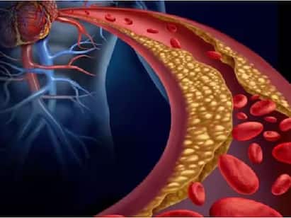 High cholesterol: Know food combinations that help in lowering the risk Health: உடம்புல கொலஸ்ட்ரால் பிரச்சனையா? அப்போ இனிமே இதெல்லாம் சாப்பிடுங்க..!