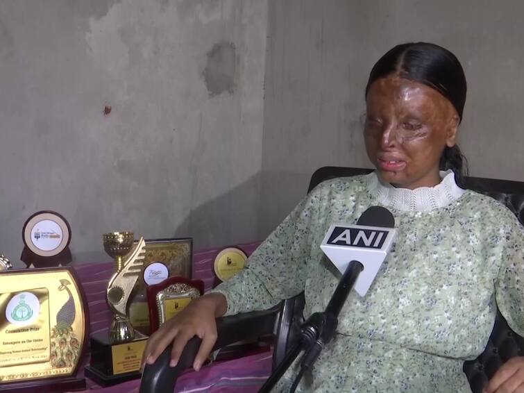 Acid Attack Survivor, Peon's Daughter Tops School With 95.20% In CBSE Class 10 Exams Acid Attack Survivor, Peon's Daughter Tops School With 95.20% In CBSE Class 10 Exams