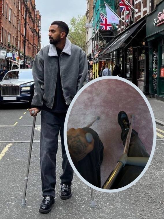 सर्जरी के बाद बैसाखी के सहारे चलते दिखे केएल राहुल