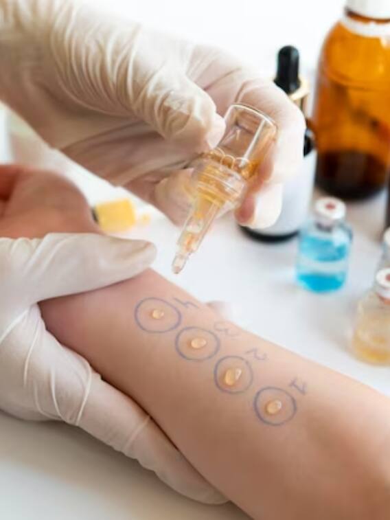 क्या है स्किन डोनेशन, क्यों है इसकी जरूरत ?