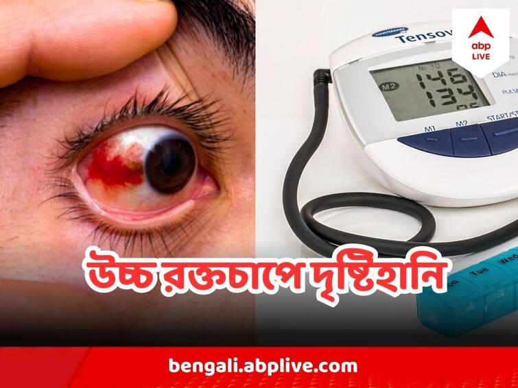 High BP Hypertension can cause serious Eye Disease even blindness Hypertension Eye Problem : হাইপারটেনশন  থেকে হতে পারে চোখের ভয়ঙ্কর রোগ, হারাতে পারেন দৃষ্টিও !