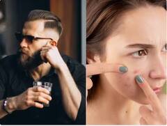 ਸਾਥੀ ਦੀ 'ਦਾੜ੍ਹੀ' ਤੁਹਾਨੂੰ ਦੇ ਸਕਦੀ ਹੈ ਇਹ ਬੀਮਾਰੀ, ਰੱਖੋ ਖ਼ਿਆਲ, ਨਹੀਂ ਤਾਂ ਵਧਣਗੀਆਂ ਮੁਸ਼ਕਿਲਾਂ