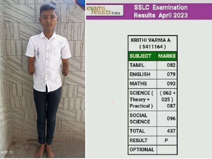 EXCLUSIVE: கைகள் போனால் என்ன? கல்வி இருக்கே... 10ஆம் வகுப்பு தேர்வில் சாதித்த க்ரித்தி வர்மாவின் நம்பிக்'கை' கதை!