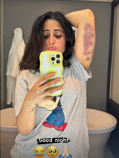 KKK13: रोहित शेट्टी ने ऐश्वर्या शर्मा को दिया ऐसा टास्क, स्टंट के दौरान बुरी तरह घायल हुईं 'गुम है' फेम ने शेयर की तस्वीर