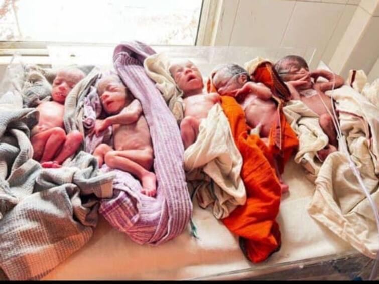 Jharkhand 27-year-old Woman Gave Birth to Five Children Quintuplets RIMS Ranchi Quintuplets: ராஞ்சி பெண்ணுக்கு ஒரே பிரசவத்தில் 5 குழந்தைகள்..! மருத்துவர்கள் ஆச்சரியம்..!