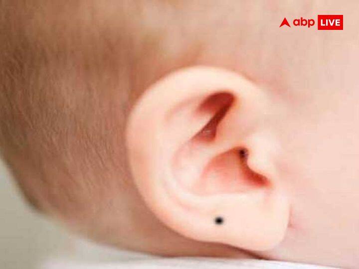 कान में तिल: जिन लोगों के दाएं कान में तिल होता है वो लोग कम उम्र में ही सफलता प्राप्त कर लेते हैं.