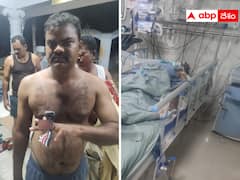 పాముకాటుతో కానిస్టేబుల్ మృతిపై చంద్రబాబు ఆవేదన - ప్రభుత్వ నిర్లక్ష్యమేనని ఆగ్రహం !