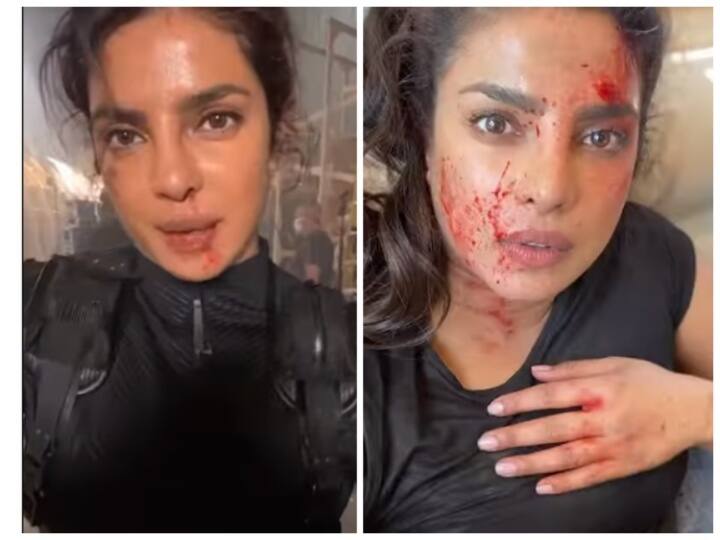 चेहरे पर खून और चोट के निशान, Priyanka Chopra ने दिखाई Citadel की शूटिंग की झलक, कहा- 'कुछ भी आसान नहीं था'
