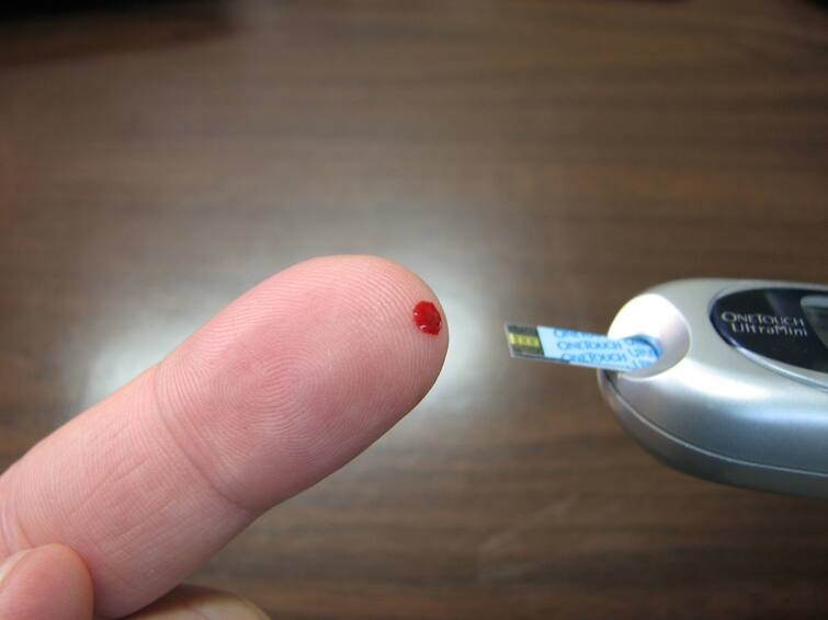 Diabetes and High Blood Sugar Level: experts predict 100 crore people get devastating diabetes by 2050 દુનિયાભરમાં ઝડપથી ફેલાઇ રહ્યો છે 'ડાયાબિટીસ'નો કહેર, 2050 સુધી એક અબજ લોકો આવી જશે આ બિમારીની ઝપેટમાં