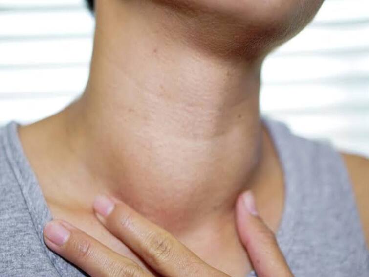 A growth under the neck maybe even a thyroid What causes Are there any solutions Find out கழுத்துக்கு கீழ வளர்ச்சி இருக்கா… தைராய்டா கூட இருக்கலாம்! எதனால் வருகிறது… தீர்வுகள் உண்டா? தெரிஞ்சுக்கோங்க!