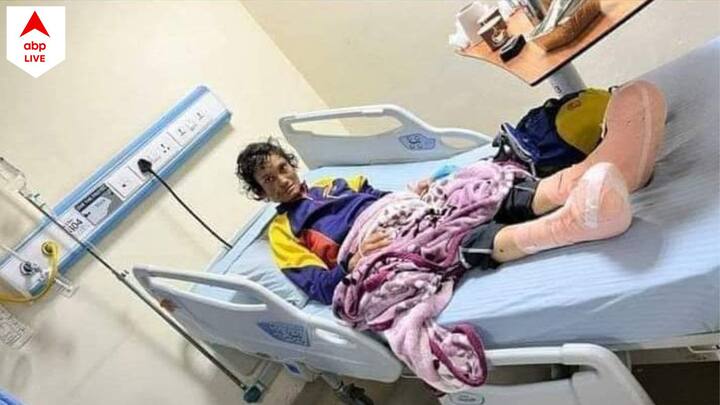 Mountaineer Piyali Basak hospitalized in Kathmandu with frost bite in both legs, know in details Piyali Basak: গুরুতর অসুস্থ পিয়ালি, দৃষ্টিশক্তি সামান্য ফিরলেও ফ্রস্ট বাইট নিয়েই উদ্বেগ