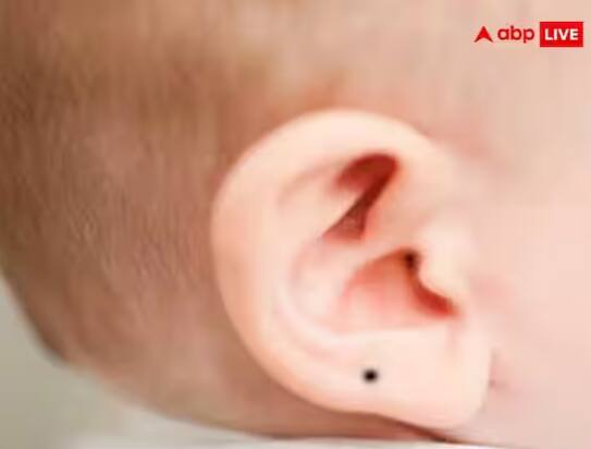 ਕੰਨ ‘ਤੇ ਤਿਲ: ਜਿਨ੍ਹਾਂ ਲੋਕਾਂ ਦੇ ਸੱਜੇ ਕੰਨ ‘ਤੇ ਤਿਲ ਹੁੰਦਾ ਹੈ, ਉਹ ਛੋਟੀ ਉਮਰ ਵਿੱਚ ਹੀ ਸਫਲਤਾ ਪ੍ਰਾਪਤ ਕਰ ਸਕਦੇ ਹਨ।