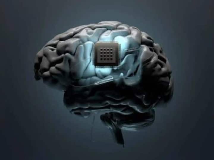 You are currently viewing इंसानी दिमाग में चिप लगने का रास्‍ता हुआ साफ, एलन मस्‍क के न्‍यूरालिंक को मिली USFDA की मंजूरी