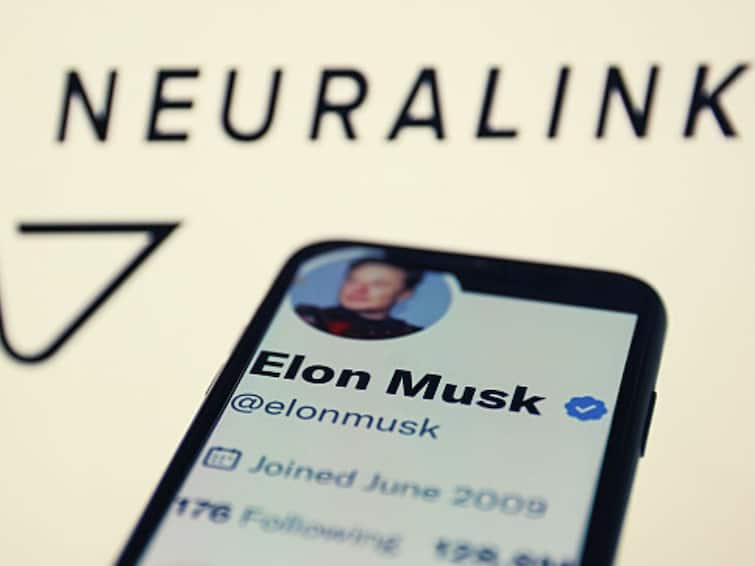 Brain Implants: Elon Musk’s Neuralink Gets US FDA Nod To Start Human Trials