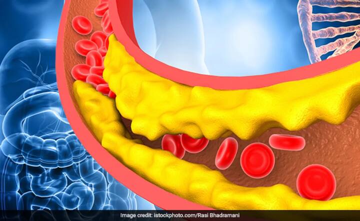 જો તમે લાંબા સમય સુધી નારંગીના રસનું સેવન કરો છો, તો તે તમારા કોલેસ્ટ્રોલનું સ્તર ઘટાડવામાં પણ મદદ કરે છે. સંતરામાં ભરપૂર માત્રામાં ફાઈબર મળી આવે છે, જેની મદદથી કોલેસ્ટ્રોલનું સ્તર મેઇન્ટેઇન થાય છે.