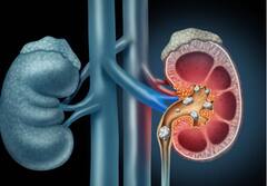 ਵਧਦੀ ਗਰਮੀ ਕਾਰਨ ਹੋ ਰਹੀ ਹੈ ਕਿਡਨੀ ਦੀ ਇਹ ਗੰਭੀਰ ਬੀਮਾਰੀ, ਸਰੀਰ 'ਤੇ ਨਜ਼ਰ ਆਉਣ ਲੱਗ ਪੈਂਦੇ ਨੇ ਇਹ ਲੱਛਣ