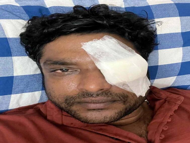 Serial actor sakthivel  eye was damaged by a stone scattered on the road Actor Sakthivel: ஹெல்மெட் போடலைன்னா ஃபைன்.. ஆனால் சாலை...? - பிரபல சின்னத்திரை நடிகருக்கு நேர்ந்த பரிதாபம்!