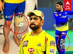 MS Dhoni to be admitted in Hospital : மருத்துவமனையில் தோனி அனுமதி? அடுத்தாண்டு விளையாடுவாரா தல?