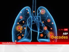 Explained: What Is Human Metapneumovirus? The Pathogen Whose Cases Saw A Recent Surge In The US