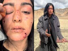 The Kerala Story: 40 घंटे बिना पानी पिए अदा शर्मा ने अफगानिस्तान में की थी शूटिंग, शेयर की होठों पर दरारे और चोट के निशान की फोटो