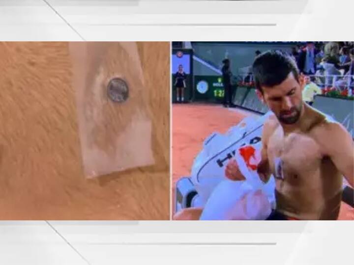 Novak Djokovic wore a mysterious nanotechnology device during tennis match Taopatch ® SPORT device benefits Novak Djokovic : काय सांगता... जोकोविचनं लावलंय Iron Manचं हार्ट? छातीवरचं छोटंसं डिव्हाईसच आहे त्याच्या यशाचं रहस्य
