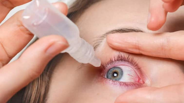 Eye infection of 35 people from indian eye drops in sri lanka the neighboring country has banned the medicines Eye drops:ભારતના આઇ ડ્રોપથી શ્રીલંકામાં 35 લોકોની આંખમાં ઇન્ફેકશન, જાણો શું છે મામલો