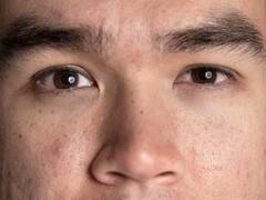 Skin Pores: ओपन पोर्स की वजह से खराब दिखने लगा है चेहरा? घर बैठे आजमाएं ये आसान टिप्स