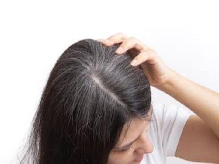 White Hair: Causes and Prevention