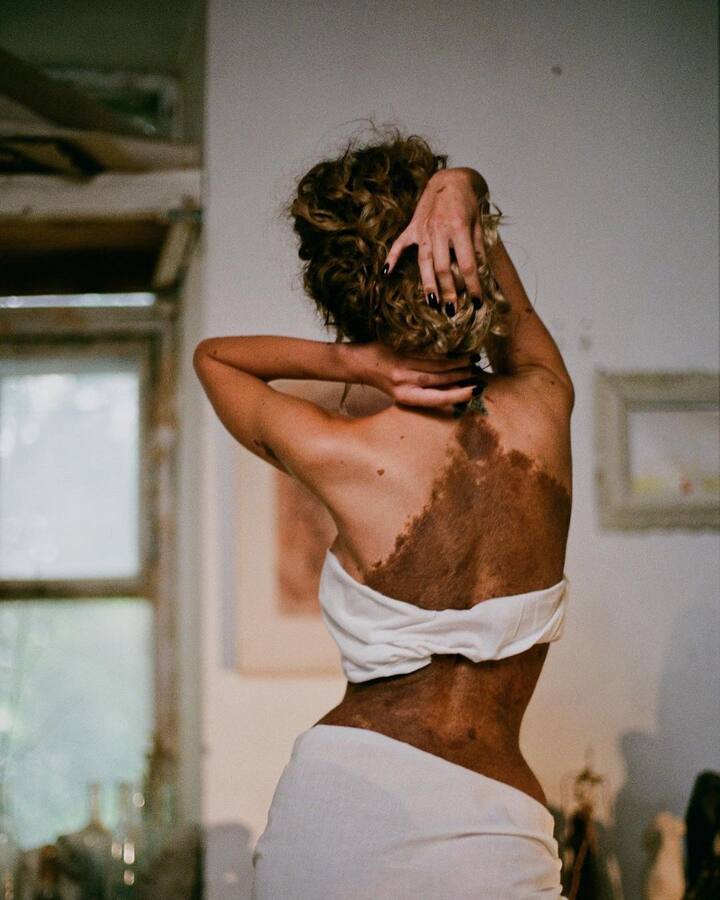 कई लोग ऐसे भी हैं, जिन्हें इसकी वजह से लोगों के मजाक और तिरस्कार का सामना भी करना पड़ जाता है. ऐसा ही कुछ पोलैंड की राजधानी वारसॉ की रहने वाली युलियाना युसेफ के साथ भी हुआ.