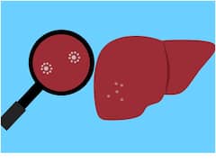 ఆకలిగా ఉండటం లేదా? ప్రమాదకరమైన వ్యాధికి ఇది ముందస్తు లక్షణం