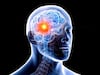 Brain Tumor: ছোটখাট মাথাব্যথা দিয়ে শুরু, উপেক্ষা করবেন না ব্রেন টিউমারের এই উপসর্গগুলি !