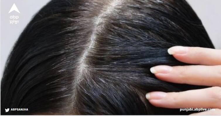 How to prevent premature white hair when you see them for the very first time on your head White Hair : ਪਹਿਲੀ ਦਫ਼ਾ ਜਦੋਂ ਸਿਰ 'ਚ ਨਜ਼ਰ ਆਉਣ ਸਫੇਦ ਵਾਲ, ਜਾਣੋ ਕੀ ਕਰਨਾ ਚਾਹੀਦੈ ਉਨ੍ਹਾਂ ਦੇ ਵਾਧੇ ਨੂੰ ਰੋਕਣ ਲਈ