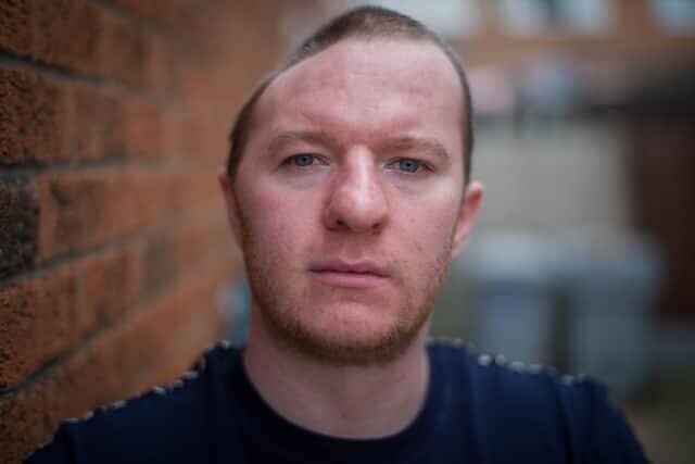 Viral News: ਅੱਧੀ ਖੋਪੜੀ ਦੇ ਨਾਲ ਰਹਿ ਰਿਹਾ ਇਹ ਆਦਮੀ! ਹਰ ਪਲ ਸਤਾ ਰਿਹਾ ਮੌਤ ਦਾ ਡਰ, ਪਰ ਅਜਿਹਾ ਕਿਵੇਂ ਹੋਇਆ? man with half of skull braden Stromberg attacked one punch by kyle Stephenson on head Viral News: ਅੱਧੀ ਖੋਪੜੀ ਦੇ ਨਾਲ ਰਹਿ ਰਿਹਾ ਇਹ ਆਦਮੀ! ਹਰ ਪਲ ਸਤਾ ਰਿਹਾ ਮੌਤ ਦਾ ਡਰ, ਪਰ ਅਜਿਹਾ ਕਿਵੇਂ ਹੋਇਆ?